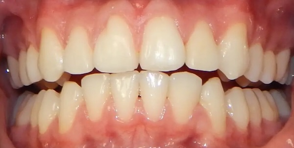 Orthodontics After